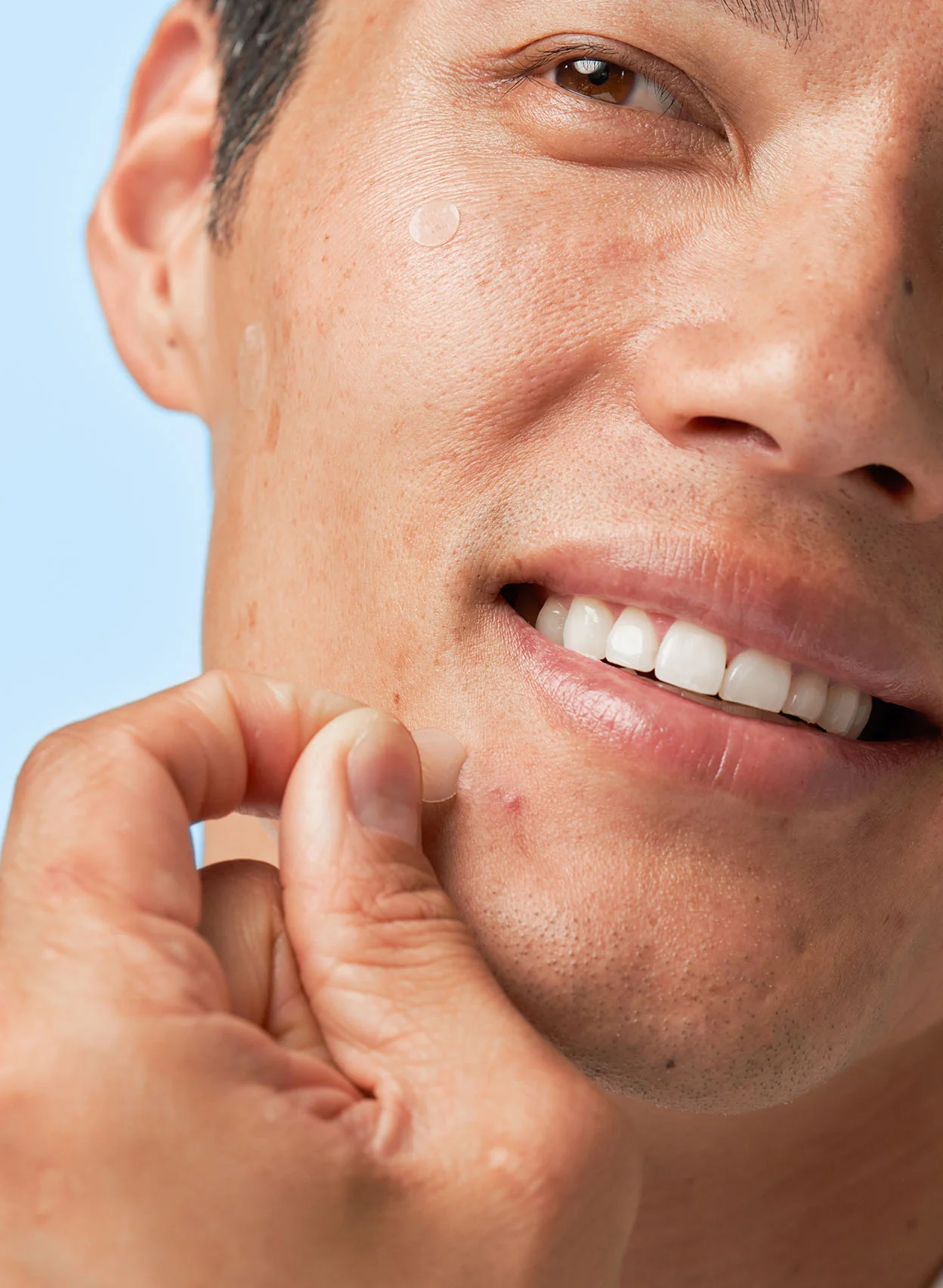 Acne Spot Dots - Image 3