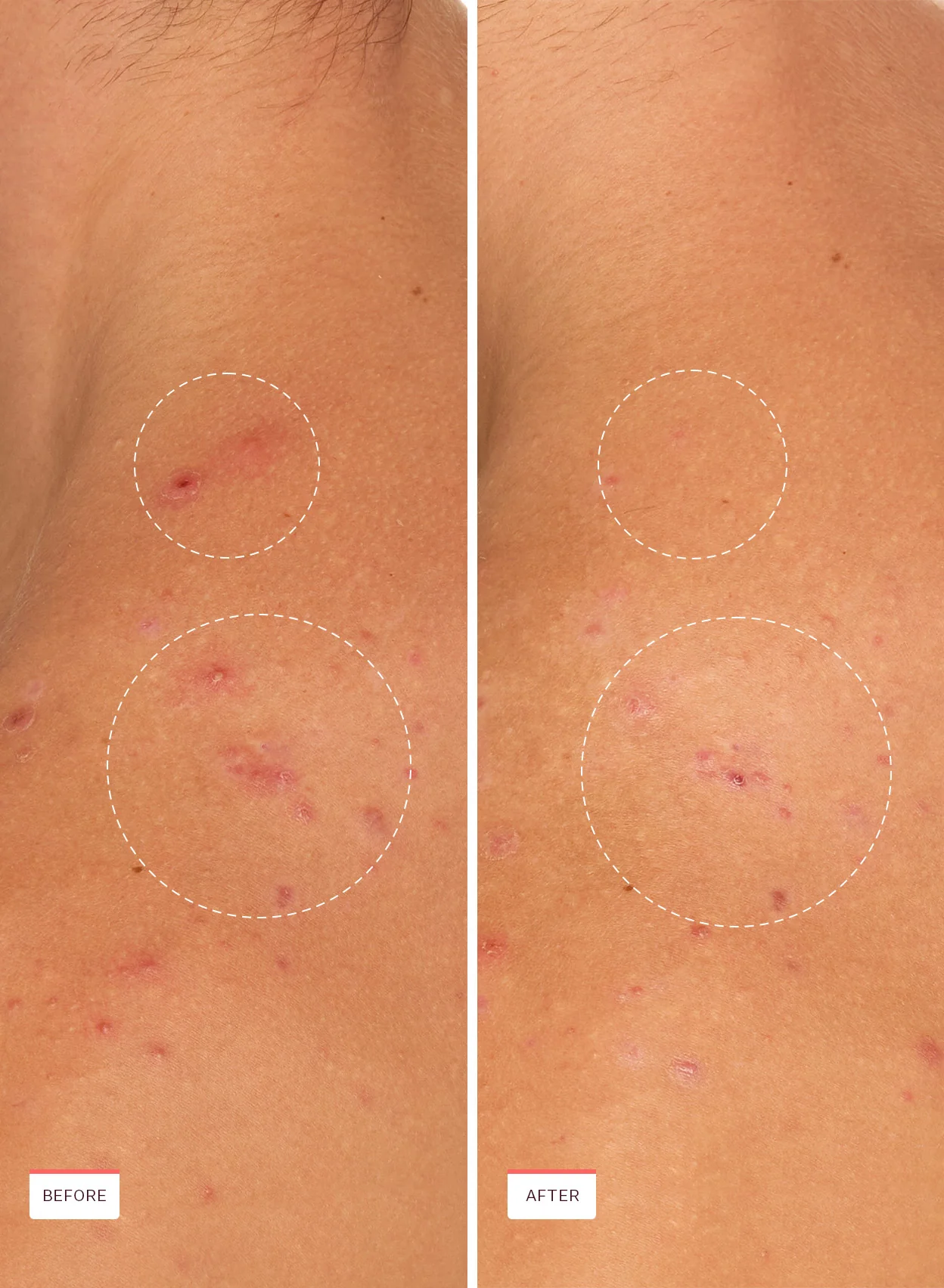 Breakout Banisher Body Spray - Image 7