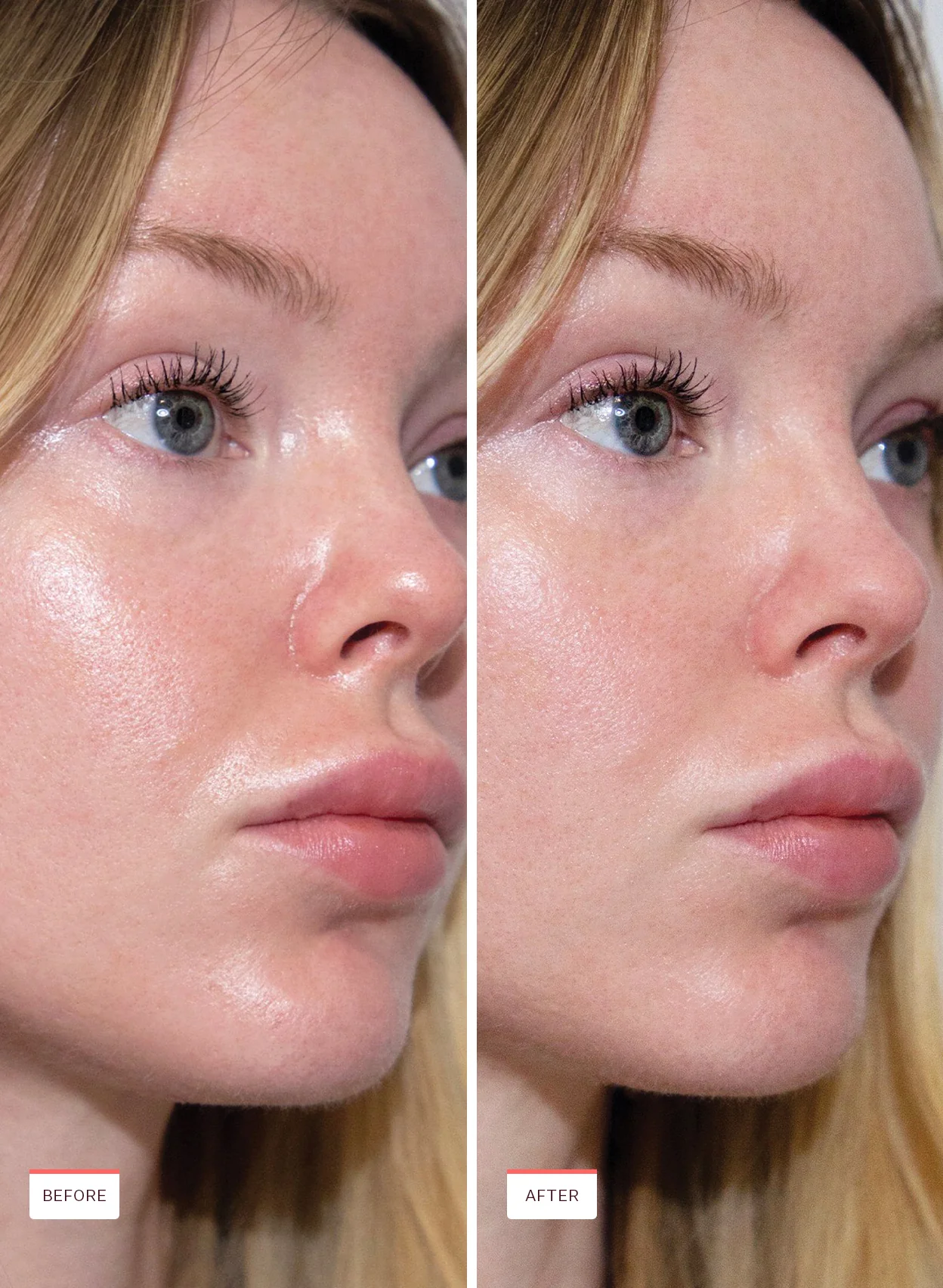 Oil Control Pore Serum - Image 7