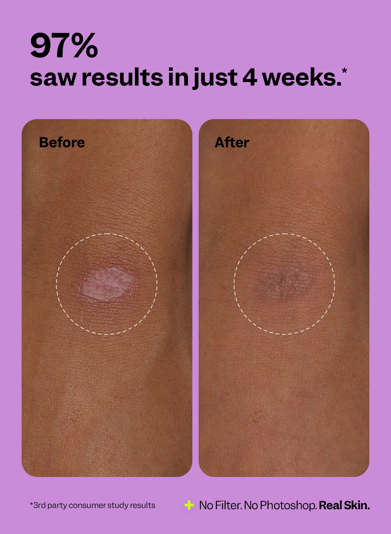 Scar Remedy Silicone Gel - Image 3
