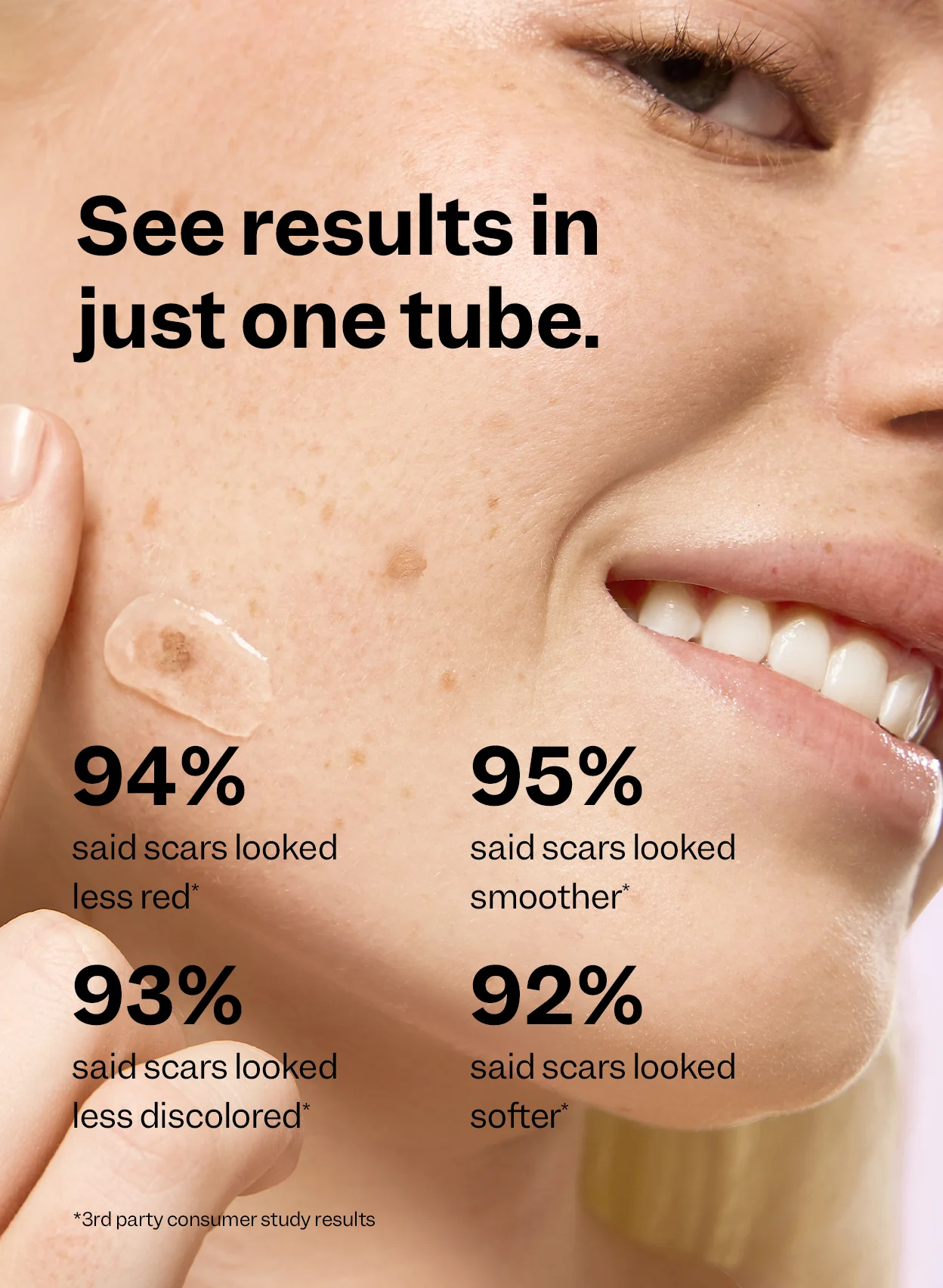 Scar Remedy Silicone Gel - Image 4