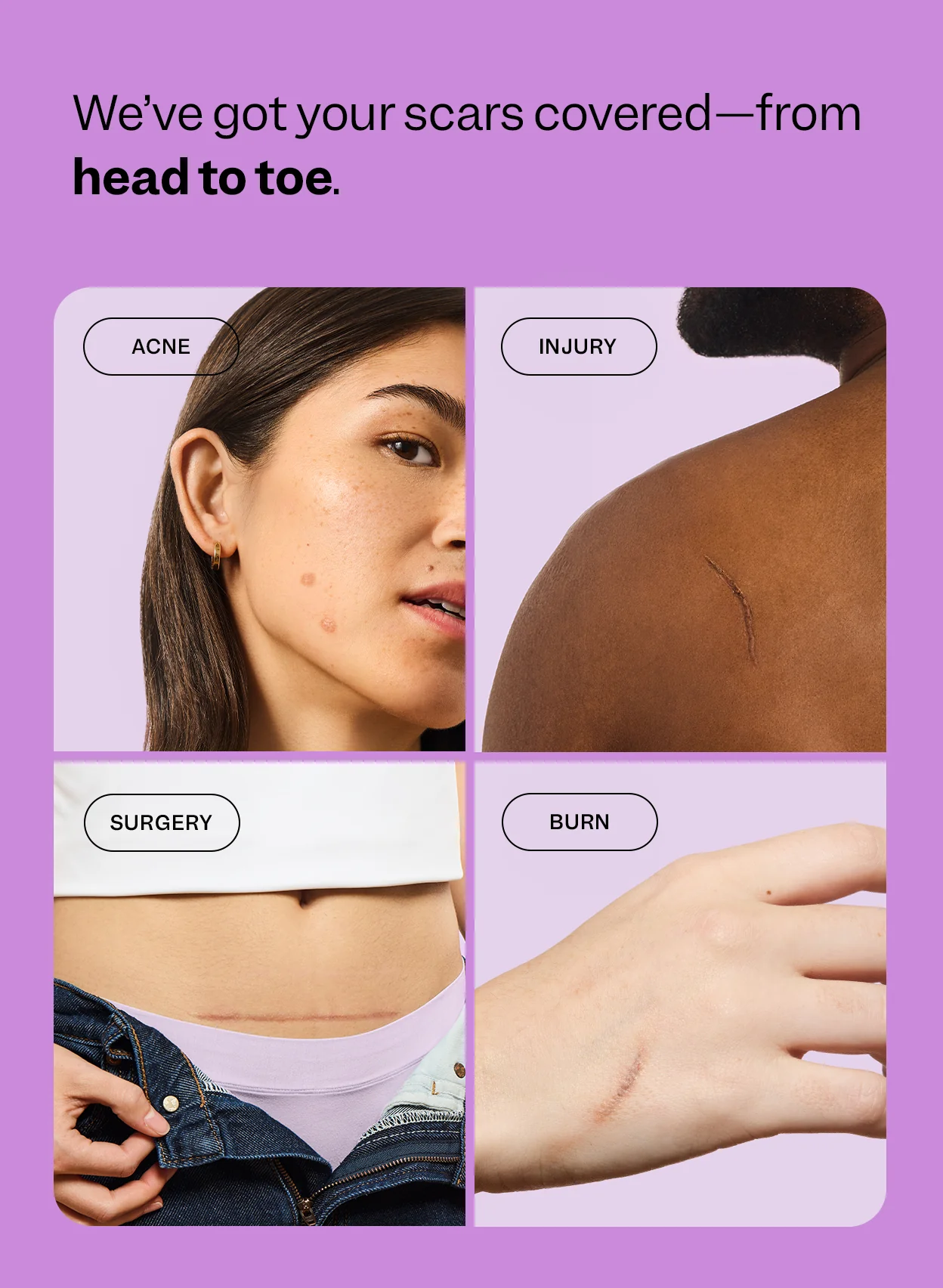 Scar Remedy Silicone Gel - Image 7