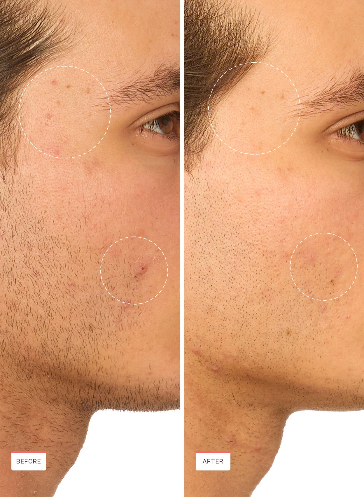 Snail Rescue Blemish Busting Toner - Image 4