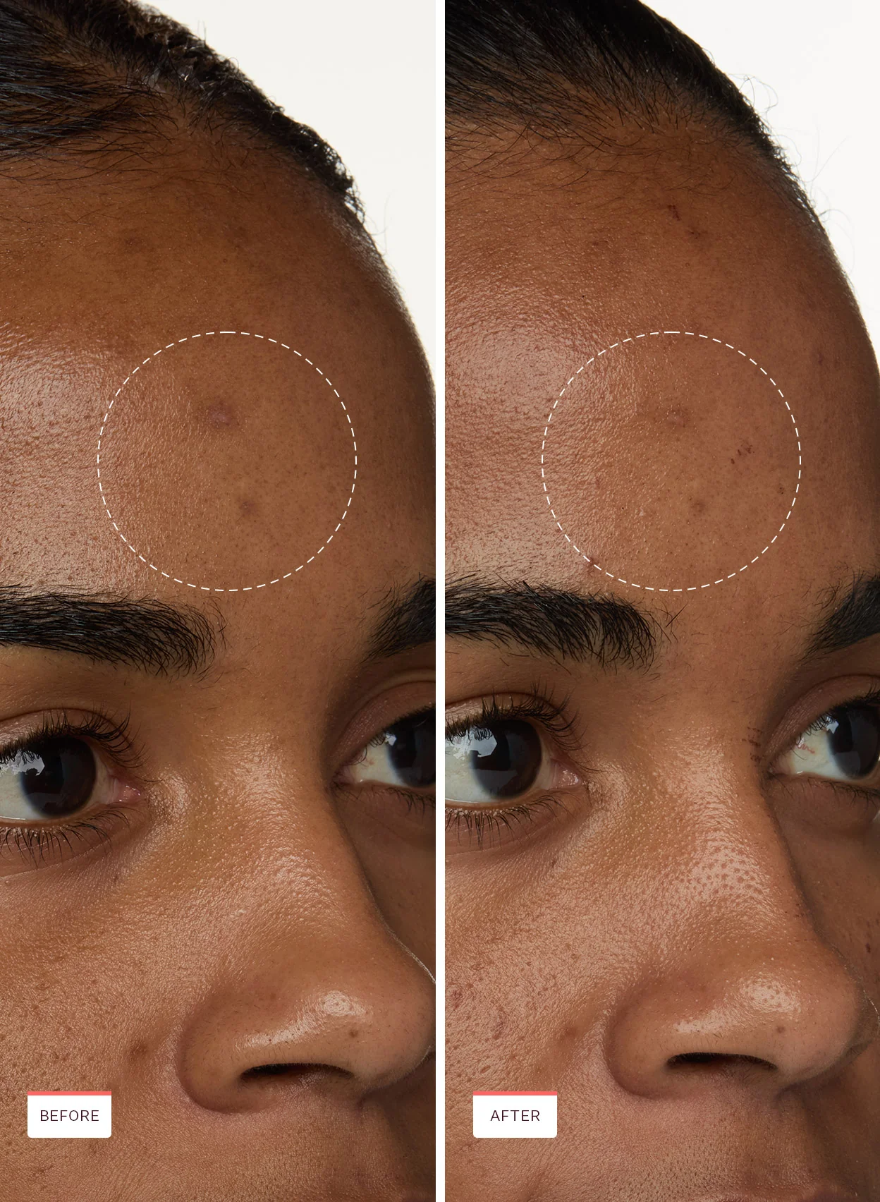 Super Fade Brightening Bundle - Image 2