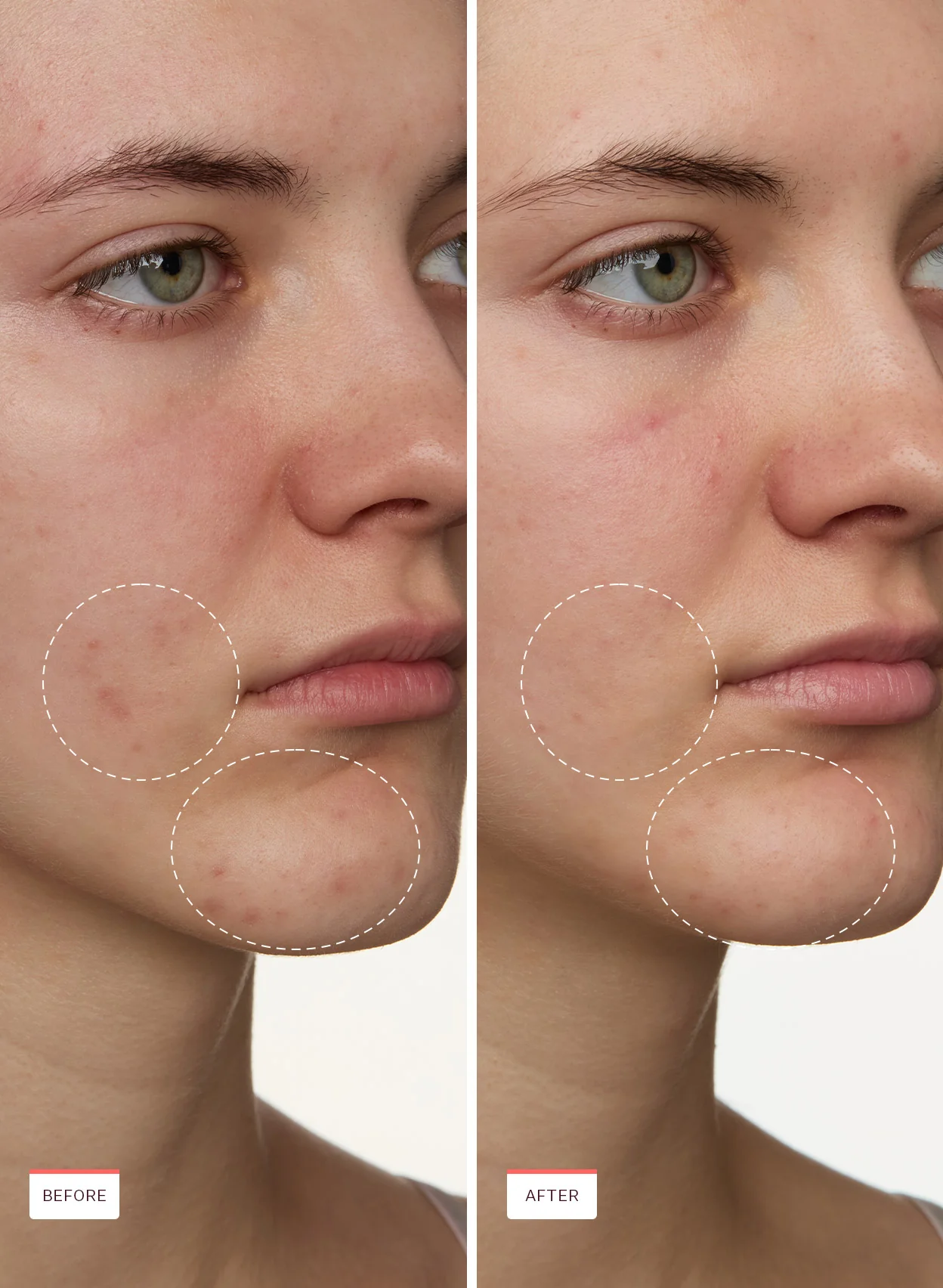 Super Fade Discoloration Serum - Image 8